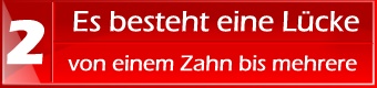 Es besteht eine Lücke innerhalb der Zahnreihe