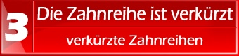 Die Zahnreihe ist verkürzt