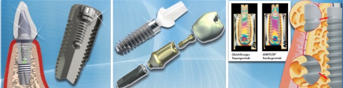Implantate