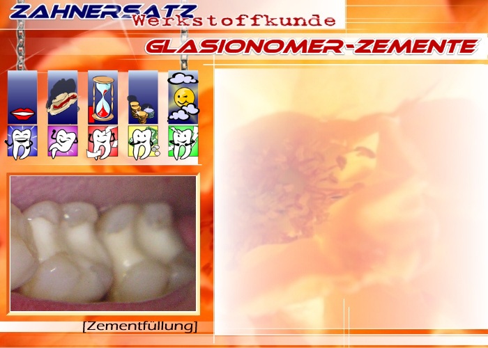 Zemente